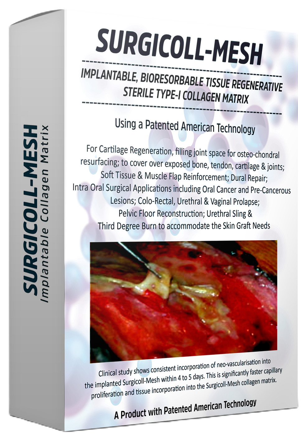 Surgicoll-Mesh Type-I Collagen regenerative surgical mesh product packaging