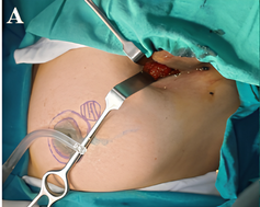 Clinical Trial Image 1