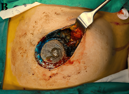 Clinical Trial Image 2