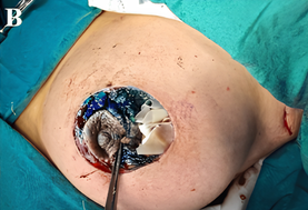 Clinical Trial Image 2