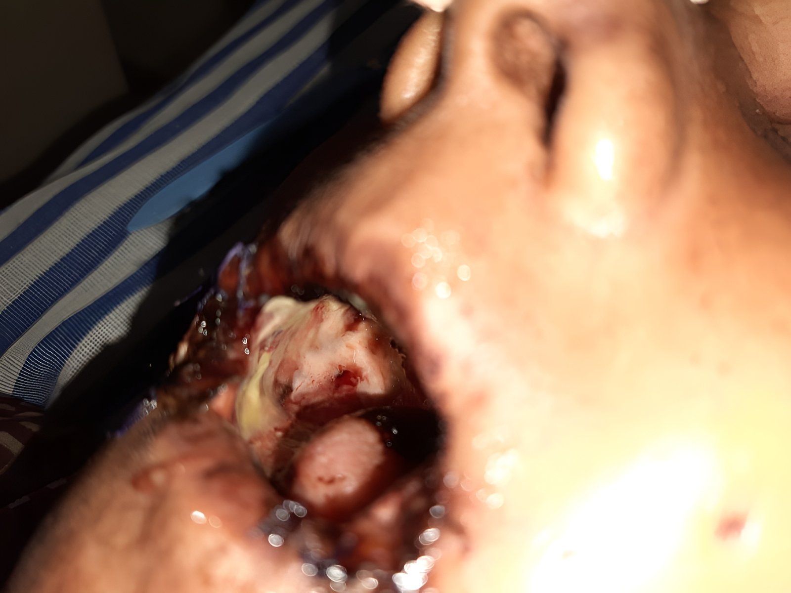 Healing Progress – Day 7