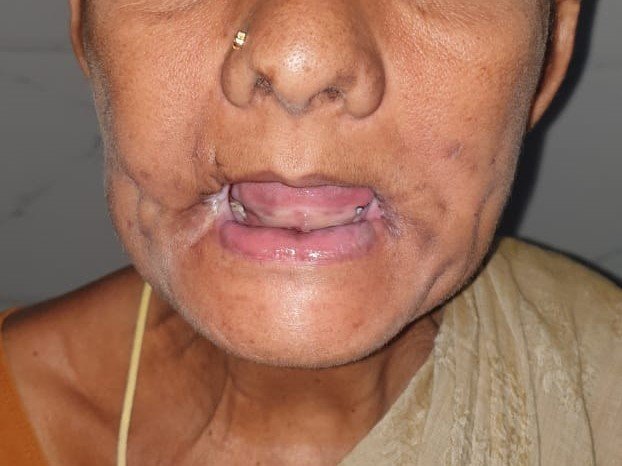 Complete Healing - Day 32
