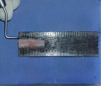 Free gingival graft harvested from palate