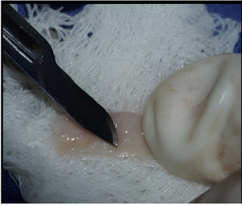 De-epithelialized extra-orally