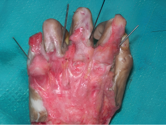 Surgical procedure Day 1