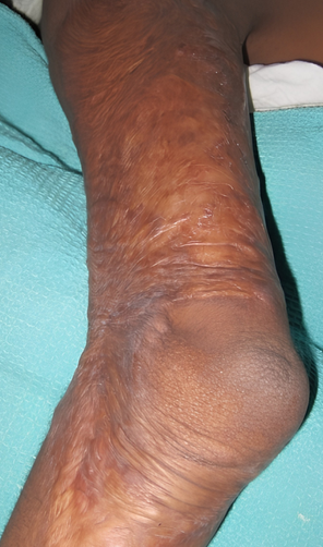 Before Surgery