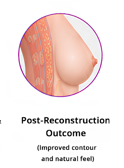 Final Reconstruction