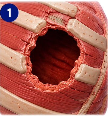 Thoracic wall defect